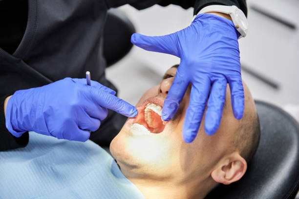 Best Dentist for Tooth Abscess  in West Wendover, NV